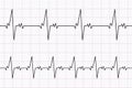 Heartbeats cardiogram. ECG heart line. Electrocardiogram paper background. Vector